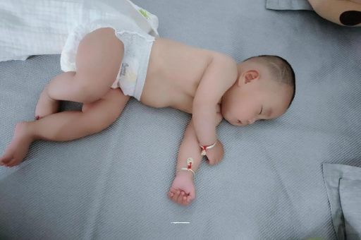 东莞宝宝头上长痱子